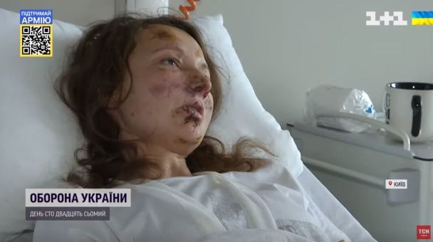 Женщина, выжившая после ракетного обстрела Киева, рассказала, как спасала себя и дочь.