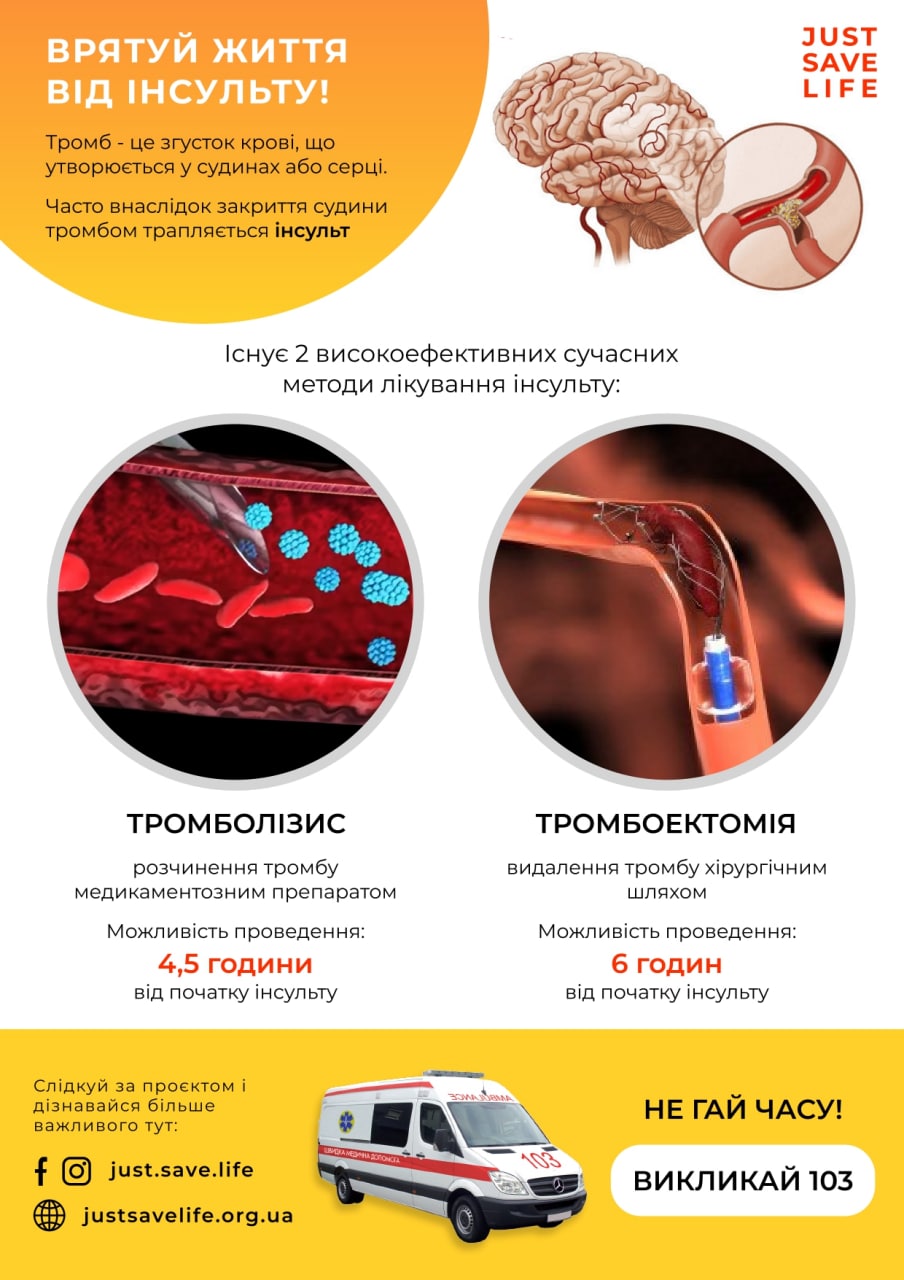 Інфографіка про ознаки інсульту, створена командою.