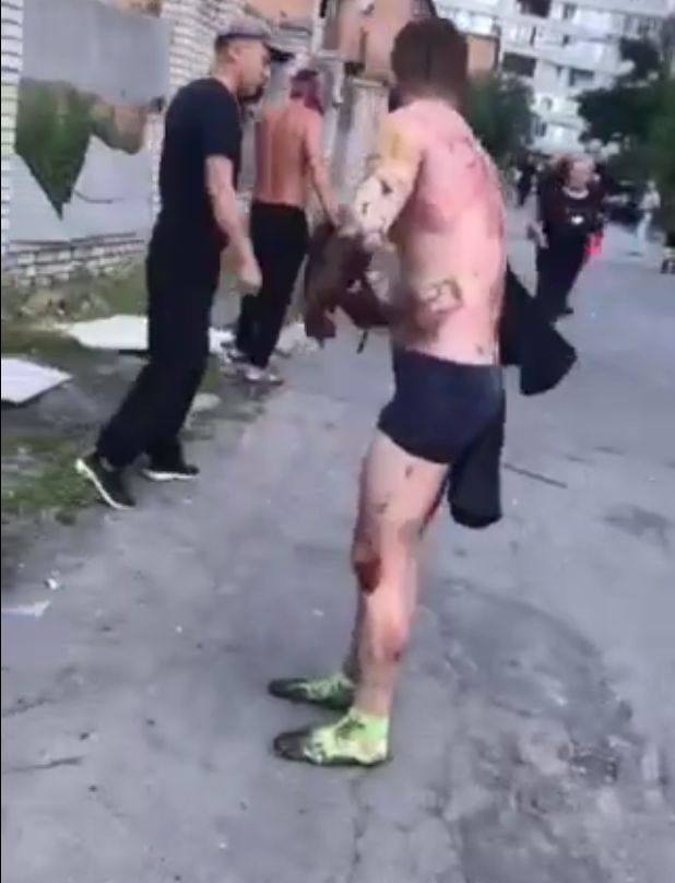 Пострадавший в результате ракетных обстрелов Винницы.