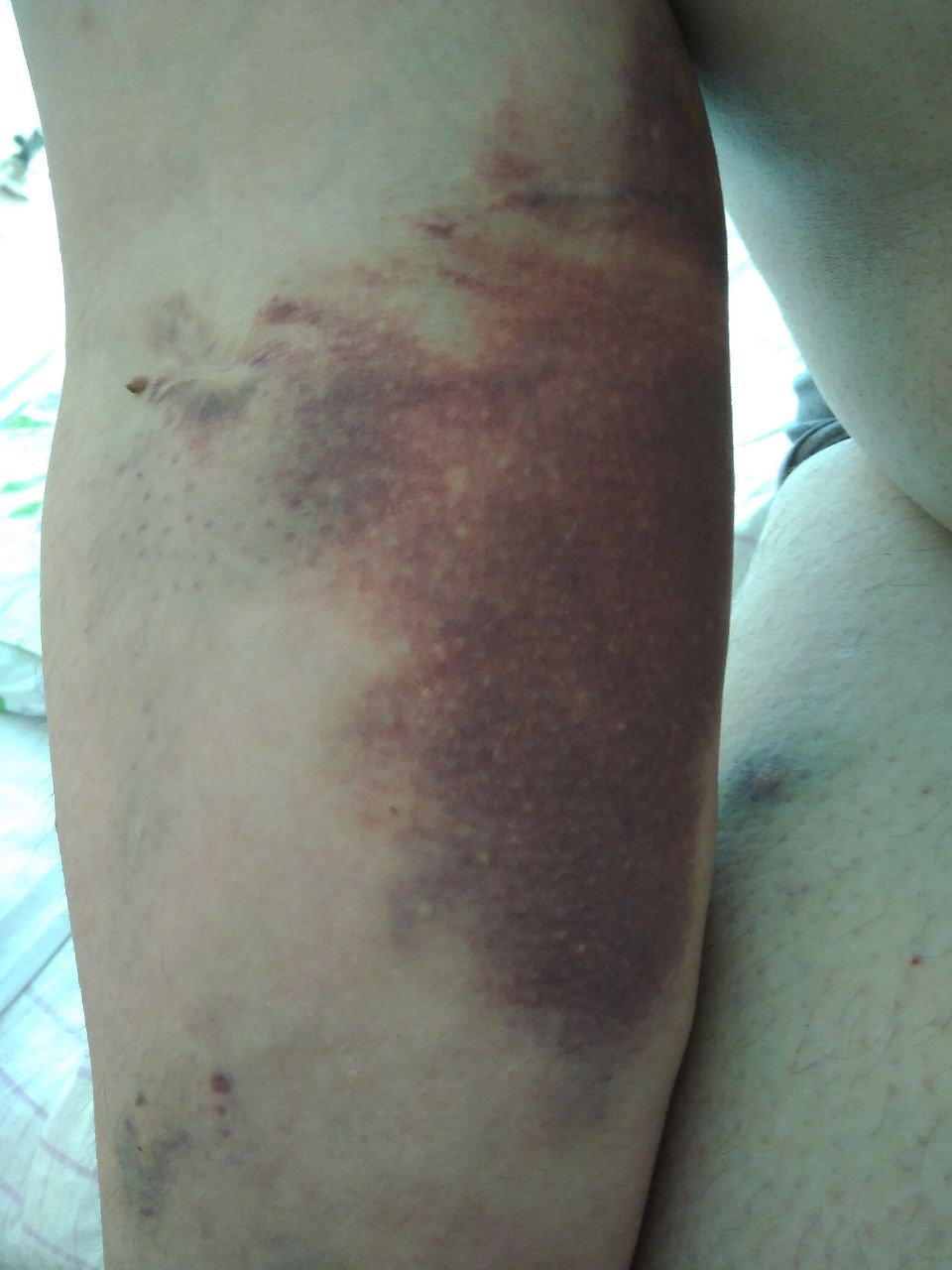 У Києві невідомі кілька днів катували білоруського журналіста Дениса Стаджі.