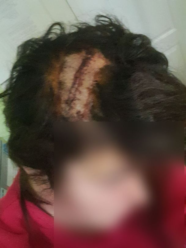 В Киеве на женщину упала ветка с дерева