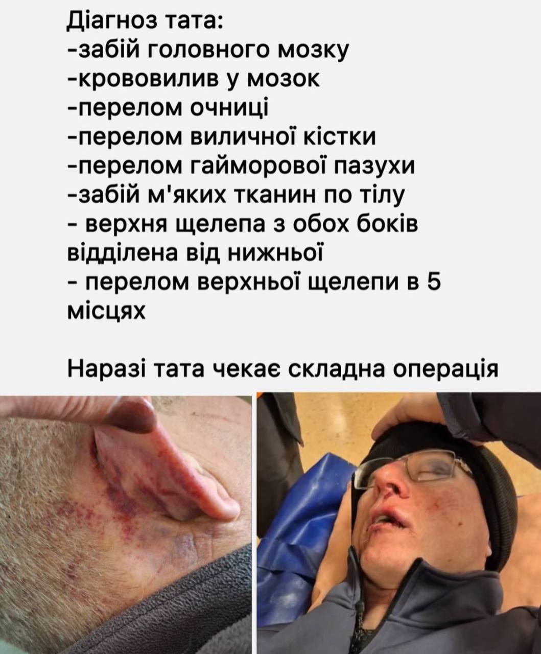 Жорстоке затримання у парку Києва: батько отримав перелом очниці та крововилив у мозок фото 3 2