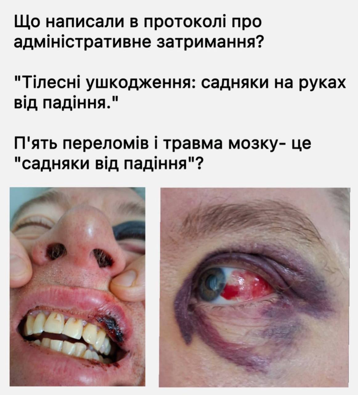 Жорстоке затримання у парку Києва: батько отримав перелом очниці та крововилив у мозок фото 4 3