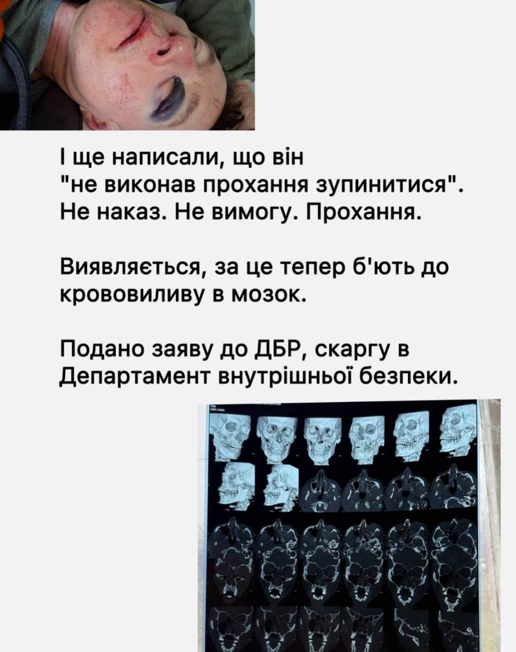 Жорстоке затримання у парку Києва: батько отримав перелом очниці та крововилив у мозок фото 5 4